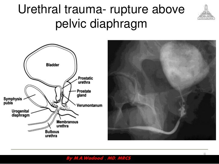 Trauma videosession v2