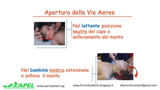 www.apel-pediatri.org www.ferrandoalberto.blogspot.it.									alberto.ferrando1@gmail.com
Apertura delle Vie Aeree
Nel lattante posizione
neutra del capo e
sollevamento del mento
Nel bambino modica estensione
e solleva il mento
 