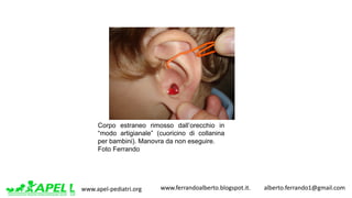 www.apel-pediatri.org www.ferrandoalberto.blogspot.it.									alberto.ferrando1@gmail.com
Corpo estraneo rimosso dall’orecchio in
“modo artigianale” (cuoricino di collanina
per bambini). Manovra da non eseguire.
Foto Ferrando
 