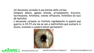 www.apel-pediatri.org www.ferrandoalberto.blogspot.it.									alberto.ferrando1@gmail.com
Un'abrasione corneale è una lesione della cornea.
Compare dolore, spesso intenso, arrossamento, bruciore,
lacrimazione, fotofobia, visione offuscata, fotofobia (la luce
dà fastidio).
L'abrasione corneale va trattata rapidamente in quanto può
guarire in 24-72 ore ma se non o maltrattata può evolvere in
ulcera, erosione e causare lesioni permanenti.
 