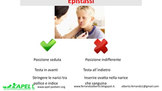 www.apel-pediatri.org www.ferrandoalberto.blogspot.it.									alberto.ferrando1@gmail.com
Epistassi
Posizione seduta Posizione	indifferente
Testa	in	avanti Testa	allʼindietro
Stringere	le	narici	tra
pollice	e	indice	
Inserire	ovatta	nella	narice
che	sanguina
 