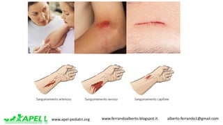 www.apel-pediatri.org www.ferrandoalberto.blogspot.it.									alberto.ferrando1@gmail.com
 