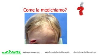www.apel-pediatri.org www.ferrandoalberto.blogspot.it.									alberto.ferrando1@gmail.com
Come la medichiamo?
 
