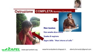 www.apel-pediatri.org www.ferrandoalberto.blogspot.it.									alberto.ferrando1@gmail.com
Ostruzione COMPLETA Bambino Cosciente
Non tossisce
Non emette alcun suono
Smette di respirare
Segno delle: “Mani intorno al collo”
 