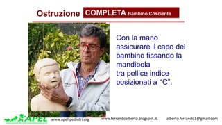 www.apel-pediatri.org www.ferrandoalberto.blogspot.it.									alberto.ferrando1@gmail.com
Ostruzione COMPLETA Bambino Cosciente
Con la mano
assicurare il capo del
bambino fissando la
mandibola
tra pollice indice
posizionati a “C”.
 