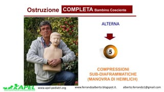 www.apel-pediatri.org www.ferrandoalberto.blogspot.it.									alberto.ferrando1@gmail.com
Ostruzione COMPLETA Bambino Cosciente
COMPRESSIONI
SUB-DIAFRAMMATICHE
(MANOVRA DI HEIMLICH)
ALTERNA	
 