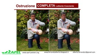 www.apel-pediatri.org www.ferrandoalberto.blogspot.it.									alberto.ferrando1@gmail.com
Ostruzione COMPLETA Lattante Cosciente
 
