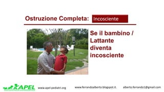 www.apel-pediatri.org www.ferrandoalberto.blogspot.it.									alberto.ferrando1@gmail.com
Se il bambino /
Lattante
diventa
incosciente
Ostruzione Completa: Incosciente
 