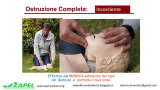 www.apel-pediatri.org www.ferrandoalberto.blogspot.it.									alberto.ferrando1@gmail.com
Cosa	Fare	?
Posiziona	su	un	
piano	rigido	
Ostruzione Completa: Incosciente
Effettua una MODICA estensione del capo
del Bambino e controlla il cavo orale
 