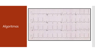 Algoritmos
 