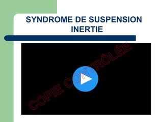 SYNDROME DE SUSPENSION
INERTIE
 