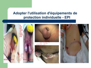 Adopter l'utilisation d'équipements de
protection individuelle - EPI
 