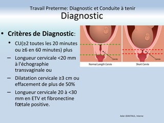 Diagnostic
• Critères de Diagnostic:
• CU(≥2 toutes les 20 minutes
ou ≥6 en 60 minutes) plus
– Longueur cervicale <20 mm
à l'échographie
transvaginale ou
– Dilatation cervicale ≥3 cm ou
effacement de plus de 50%
– Longueur cervicale 20 à <30
mm en ETV et fibronectine
fœtale positive.
Travail Preterme: Diagnostic et Conduite à tenir
Axler JEAN PAUL, Interne
 