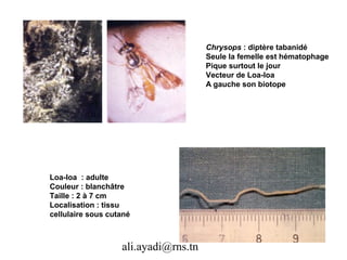 Chrysops : diptère tabanidé
                                      Seule la femelle est hématophage
                                      Pique surtout le jour
                                      Vecteur de Loa-loa
                                      A gauche son biotope




Loa-loa : adulte
Couleur : blanchâtre
Taille : 2 à 7 cm
Localisation : tissu
cellulaire sous cutané



                   ali.ayadi@rns.tn
 