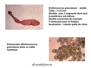 Echinococcus granulosus : adulte
                                 Taille : 3 à 6 mm
                                 Strobile avec 3 segments dont seul
                                 le postérieur est mâture
                                 Double couronnes de crochets
                                 4 ventouses pour la fixation
                                 localisation : intestin grêle du chien




Protoscolex dEchinococcus
granulosus dans un sable
hydatique




                    ali.ayadi@rns.tn
 