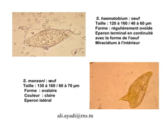 S. haematobium : oeuf
                                     Taille : 120 à 160 / 40 à 60 µm
                                     Forme : régulièrement ovoïde
                                     Eperon terminal en continuité
                                     avec la forme de l'oeuf
                                     Miracidium à l'intérieur




S. mansoni : œuf
Taille : 130 à 160 / 60 à 70 µm
 Forme : ovalaire
 Couleur : claire
 Eperon latéral


                  ali.ayadi@rns.tn
 