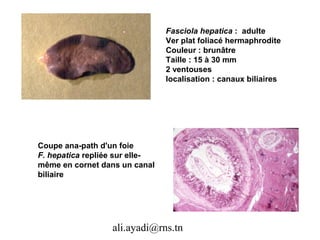 Fasciola hepatica : adulte
                                Ver plat foliacé hermaphrodite
                                Couleur : brunâtre
                                Taille : 15 à 30 mm
                                2 ventouses
                                localisation : canaux biliaires




Coupe ana-path d'un foie
F. hepatica repliée sur elle-
même en cornet dans un canal
biliaire




                  ali.ayadi@rns.tn
 