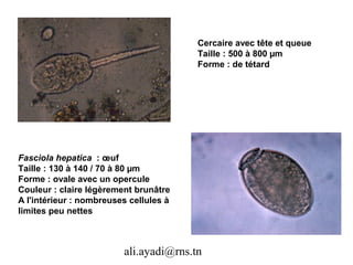 Cercaire avec tête et queue
                                        Taille : 500 à 800 µm
                                        Forme : de tétard




Fasciola hepatica : œuf
Taille : 130 à 140 / 70 à 80 µm
Forme : ovale avec un opercule
Couleur : claire légèrement brunâtre
A l'intérieur : nombreuses cellules à
limites peu nettes



                         ali.ayadi@rns.tn
 
