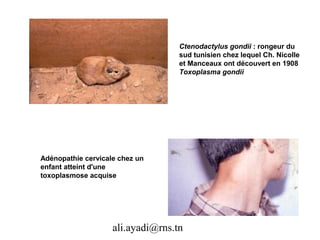 Ctenodactylus gondii : rongeur du
                                   sud tunisien chez lequel Ch. Nicolle
                                   et Manceaux ont découvert en 1908
                                   Toxoplasma gondii




Adénopathie cervicale chez un
enfant atteint d'une
toxoplasmose acquise




                    ali.ayadi@rns.tn
 