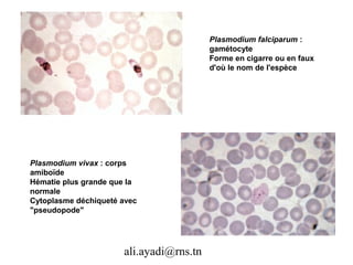 Plasmodium falciparum :
                                         gamétocyte
                                         Forme en cigarre ou en faux
                                         d'où le nom de l'espèce




Plasmodium vivax : corps
amiboïde
Hématie plus grande que la
normale
Cytoplasme déchiqueté avec
"pseudopode"




                      ali.ayadi@rns.tn
 