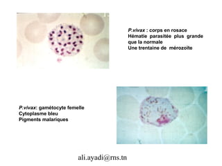 P.vivax : corps en rosace
                                           Hématie parasitée plus grande
                                           que la normale
                                           Une trentaine de mérozoïte




P.vivax: gamétocyte femelle
Cytoplasme bleu
Pigments malariques




                        ali.ayadi@rns.tn
 