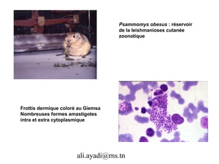 Psammomys obesus : réservoir
                                    de la leishmanioses cutanée
                                    zoonotique




Frottis dermique coloré au Giemsa
Nombreuses formes amastigotes
intra et extra cytoplasmique




                       ali.ayadi@rns.tn
 