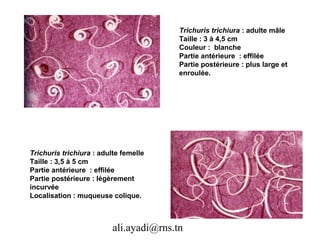 Trichuris trichiura : adulte mâle
                                         Taille : 3 à 4,5 cm
                                         Couleur : blanche
                                         Partie antérieure : effilée
                                         Partie postérieure : plus large et
                                         enroulée.




Trichuris trichiura : adulte femelle
Taille : 3,5 à 5 cm
Partie antérieure : effilée
Partie postérieure : légèrement
incurvée
Localisation : muqueuse colique.



                          ali.ayadi@rns.tn
 