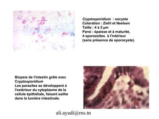 Cryptosporidium : oocyste
                                       Coloration : Ziehl et Neelsen
                                       Taille : 4 à 5 µm
                                       Paroi : épaisse et à maturité,
                                       4 sporozoïtes à l'intérieur
                                       (sans présence de sporocyste).




Biopsie de l'intestin grêle avec
Cryptosporidium
Les parasites se développent à
l'extérieur du cytoplasme de la
cellule épithéliale, faisant saillie
dans la lumière intestinale.



                           ali.ayadi@rns.tn
 