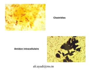 Clostridies




Amidon intracellulaire




                ali.ayadi@rns.tn
 