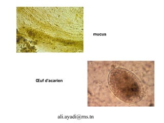 mucus




Œuf d'acarien




          ali.ayadi@rns.tn
 