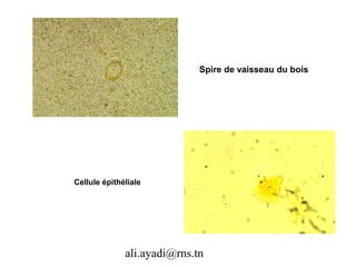 Spire de vaisseau du bois




Cellule épithéliale




              ali.ayadi@rns.tn
 