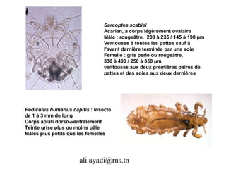 Sarcoptes scabiei
                                Acarien, à corps légèrement ovalaire
                                Mâle : rougeâtre, 200 à 235 / 145 à 190 µm
                                Ventouses à toutes les pattes sauf à
                                l'avant dernière terminée par une soie
                                Femelle : gris perle ou rougeâtre,
                                330 à 400 / 250 à 350 µm
                                ventouses aux deux premières paires de
                                pattes et des soies aux deux dernières




Pediculus humanus capitis : insecte
de 1 à 3 mm de long
Corps aplati dorso-ventralement
Teinte grise plus ou moins pâle
Mâles plus petits que les femelles




                      ali.ayadi@rns.tn
 