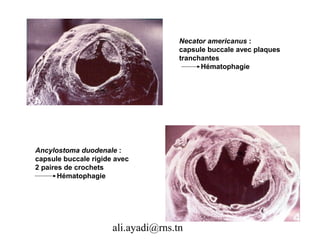 Necator americanus :
                                     capsule buccale avec plaques
                                     tranchantes
                                           Hématophagie




Ancylostoma duodenale :
capsule buccale rigide avec
2 paires de crochets
       Hématophagie




                      ali.ayadi@rns.tn
 
