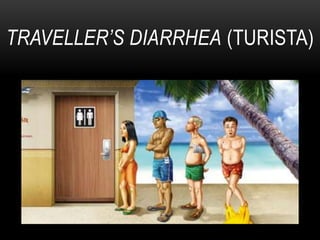 TRAVELLER’S DIARRHEA (TURISTA)
 