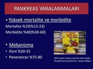 TedaviPrimer tamirEksizyon, anastomozRoux limb coverageWhippleÇok nadir