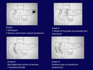Ana hepatik kanal yaralanması %15Kapsül sağlam olsa bile pankreatik kanal yaralanması olasılığı VARDIR