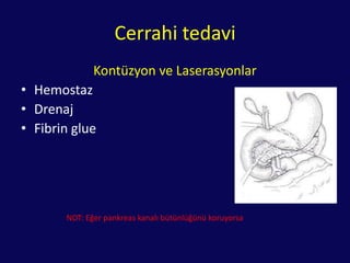 Grade I• Kontüzyon• Duktusu içermeyen yüzeyel yaralanmaGrade II• Gövde ve kuyrukta ana kanalda tamlaserasyonGrade IIIBaş bölgesinde ezilme ve kesilme• DuodenumintaktGrade IVPankreas başı ve duodenum yaralanması