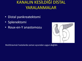 ERCP/MRCPStabil hastada erken görüntüleme