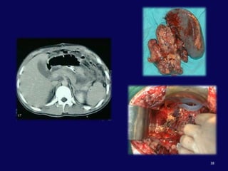 Yaralanma yoksa = Konservatif tedavi
