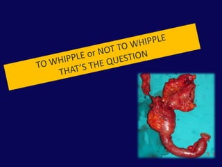 Kombine Pankreatikoduodenal YaralanmalarPrimer duodenal onarımPankreatik drenajDuodenal dekompresyon              Üç tüp dekompresyonu              Gastrostomi ve duodenostomi              Duodenal divertikülizasyon