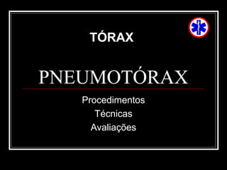 PNEUMOTÓRAX
Procedimentos
Técnicas
Avaliações
TÓRAX
 