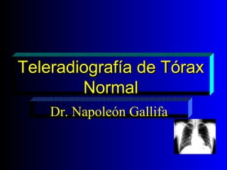 Teleradiografía de Tórax Normal Dr. Napoleón Gallifa 