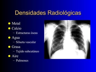 Densidades Radiológicas Metal Calcio Estructuras óseas Agua Silueta vascular Grasa Tejido subcutáneo Aire Pulmones
