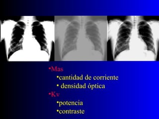 Mas cantidad de corriente densidad óptica Kv potencia contraste
