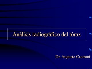 Análisis radiográfico del tórax
Dr. Augusto Castroni
 