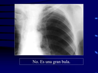 No. Es una gran bula.
 