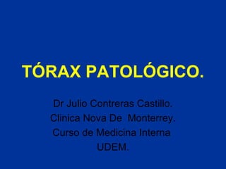 TÓRAX PATOLÓGICO.
Dr Julio Contreras Castillo.
Clinica Nova De Monterrey.
Curso de Medicina Interna
UDEM.
 