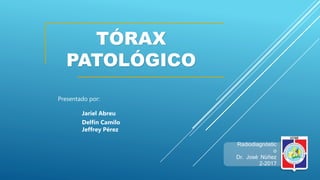 TÓRAX
PATOLÓGICO
Radiodiagnóstic
o
Dr. José Núñez
2-2017
Presentado por:
Jariel Abreu
Delfín Camilo
Jeffrey Pérez
 
