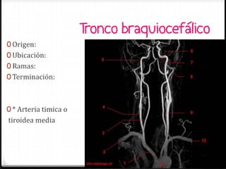 Tronco braquiocefálico
0 Origen:
0 Ubicación:
0 Ramas:
0 Terminación:



0 * Arteria timica o
tiroidea media



                        Tatiana Medina Ramírez
 