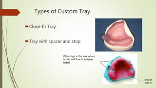 Types of Custom Tray
Close-fit Tray
Tray with spacer and stop
SPACER
(WAX)
(Openings in the wax where
acrylic will flow in to form
stops)
 